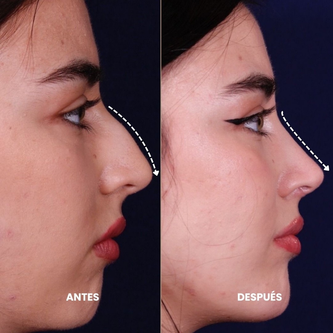Funcionalidad respiratoria Nova Imagem